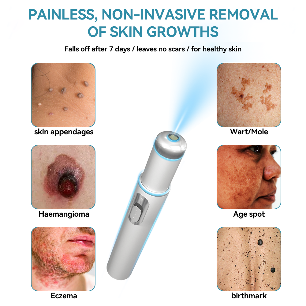 ๐๐๐ฌ๐ฌ๐๐๐ฆยฎ Medical-Grade Laser Pen ๐ (uses COโ laser technology โ effectively removes moles, warts, skin tags, pigmentation spots, and other blemishes)๐ฅ