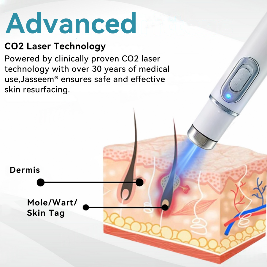 ๐๐๐ฌ๐ฌ๐๐๐ฆยฎ Medical-Grade Laser Pen ๐ (uses COโ laser technology โ effectively removes moles, warts, skin tags, pigmentation spots, and other blemishes)๐ฅ