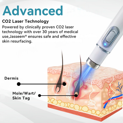 𝐉𝐚𝐬𝐬𝐞𝐞𝐦® Medical-Grade Laser Pen 🎉 (uses CO₂ laser technology – effectively removes moles, warts, skin tags, pigmentation spots, and other blemishes)🔥